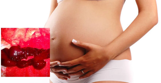 Mẹ bầu bị rau tiền đạo nặng, chảy máu cục có nguy cơ sảy thai