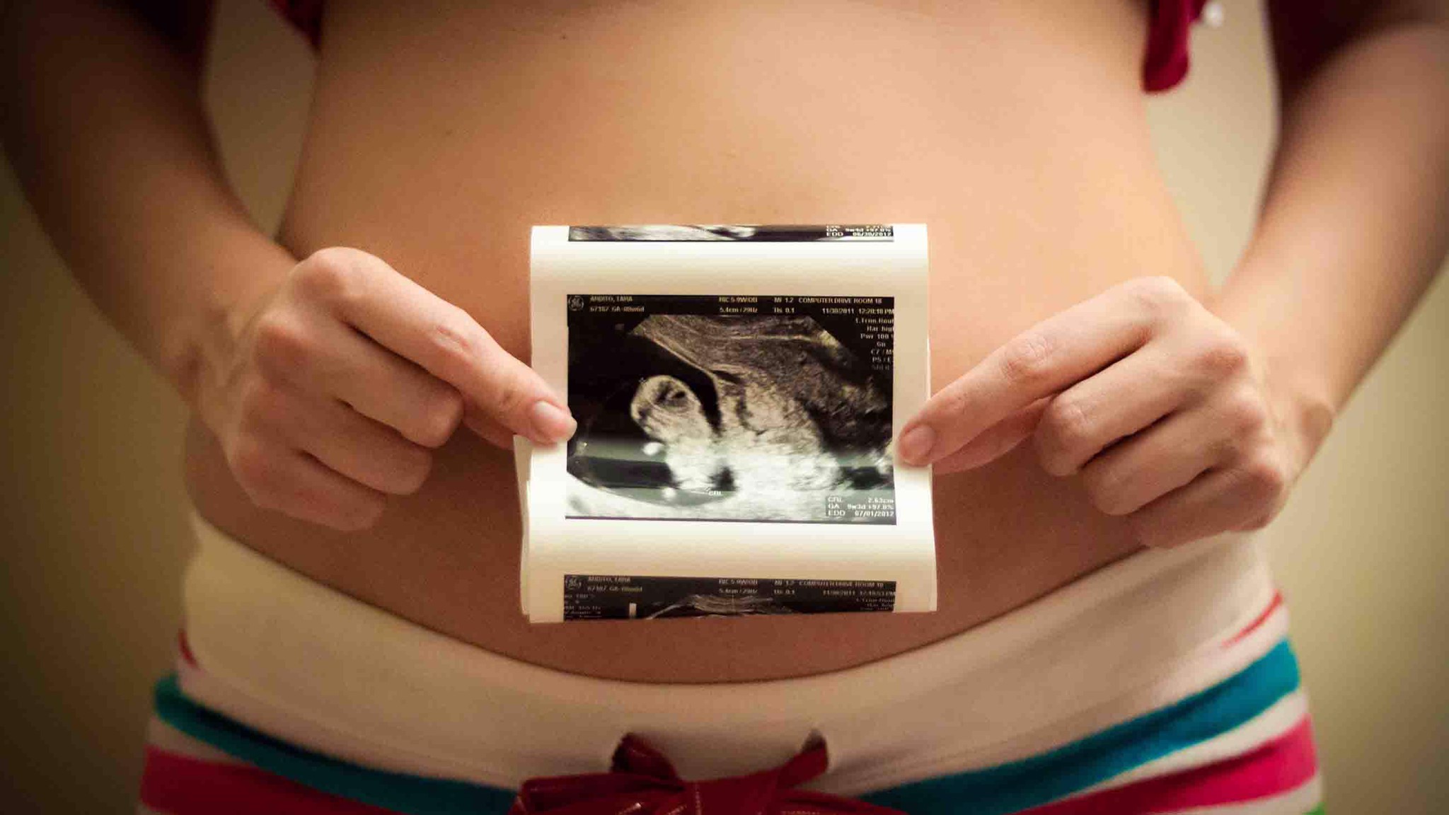 Bóc tách túi thai 50% nên làm gì để giữ được con? 1